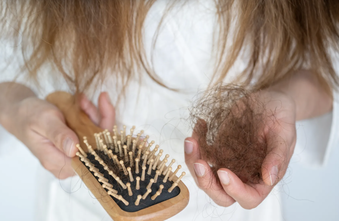 EXPERT COMMENTARY: How this food could be contributing to hair loss